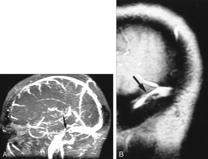 Fig 3.