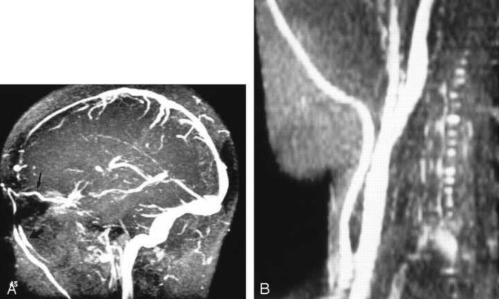 Fig 5.