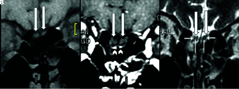 FIG 1.