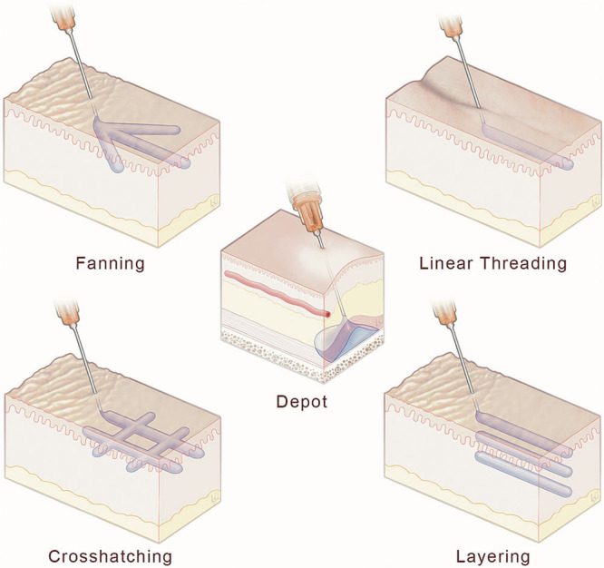 Fig. 3.