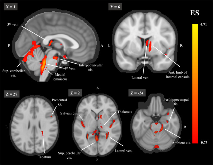 FIGURE 4