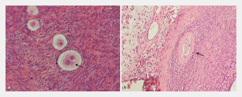 Fig. 4