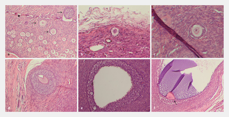 Fig. 3