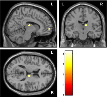 Fig. 3