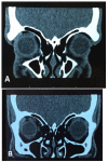 Fig. 3A,B