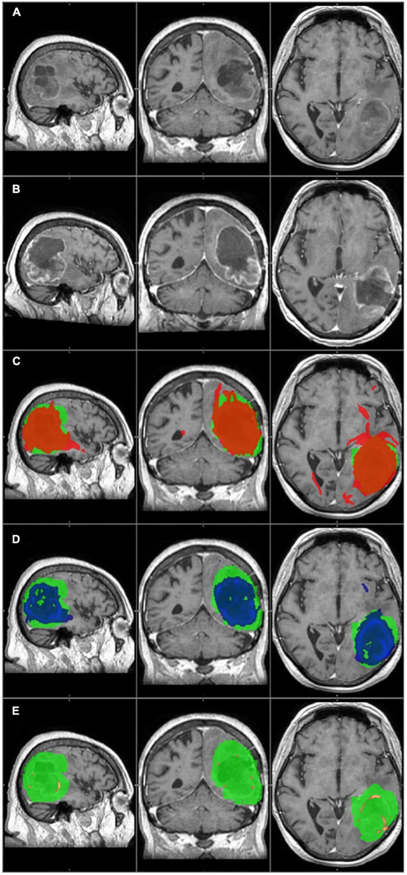 FIGURE 2