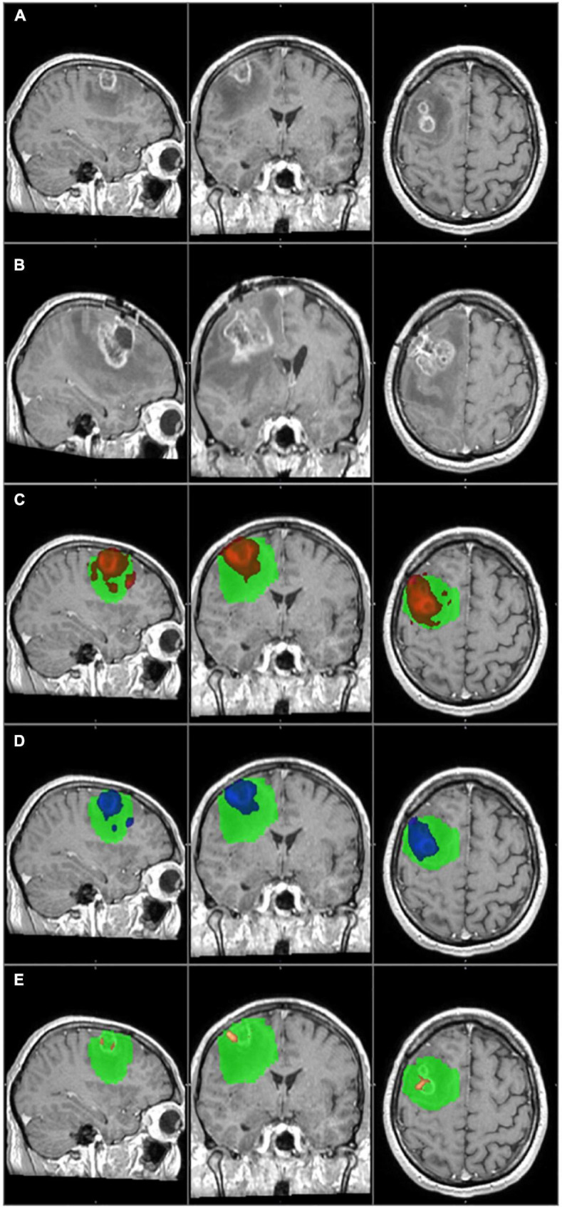 FIGURE 4