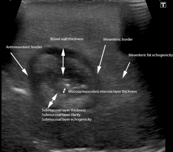 Fig. 1