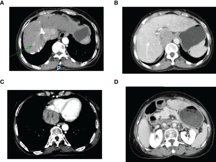 Figure 1