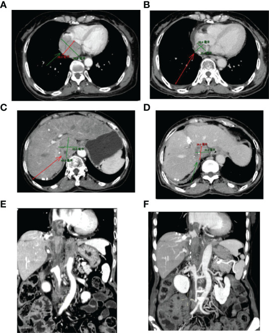 Figure 3