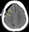 Fig 4