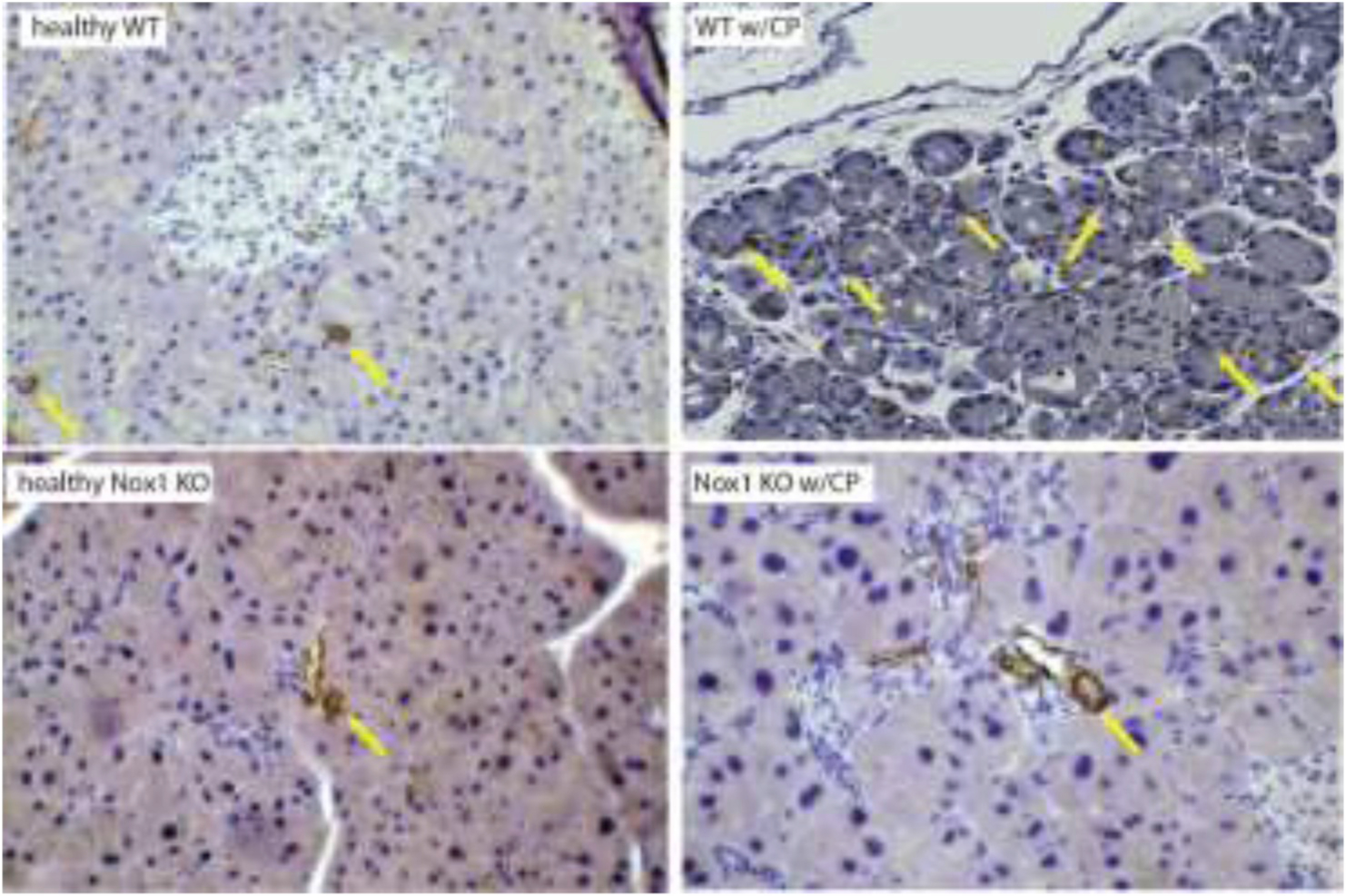 Fig. 2A.