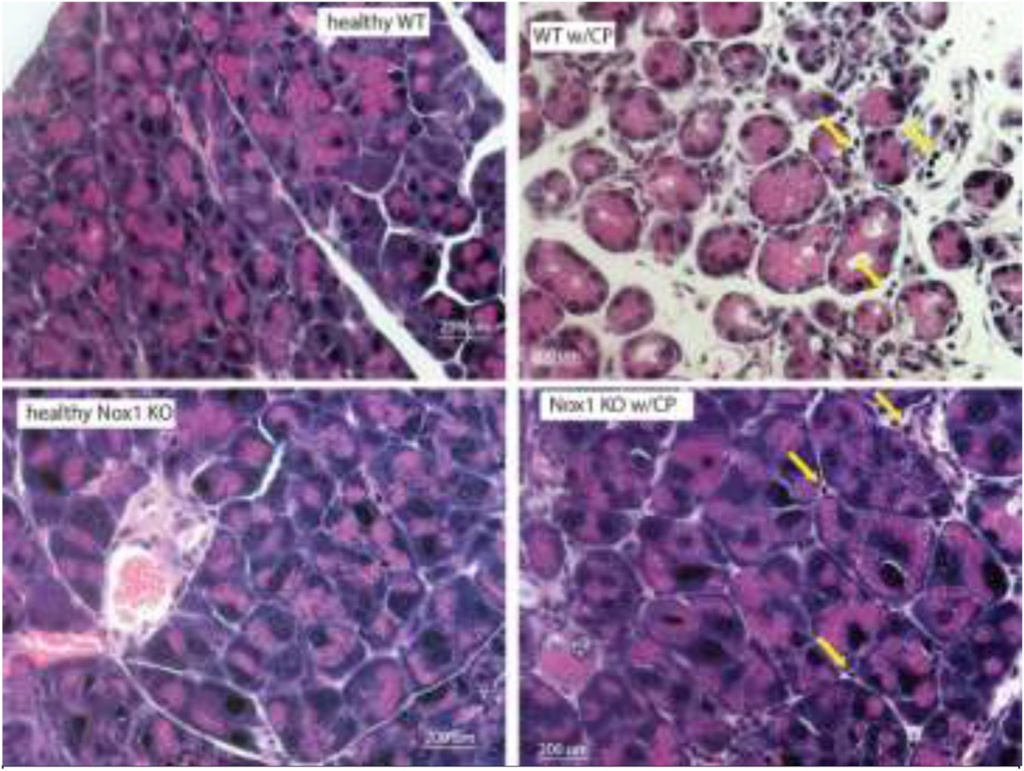 Fig. 1B.