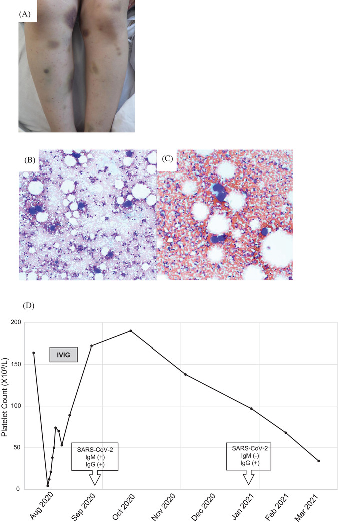 FIGURE 1