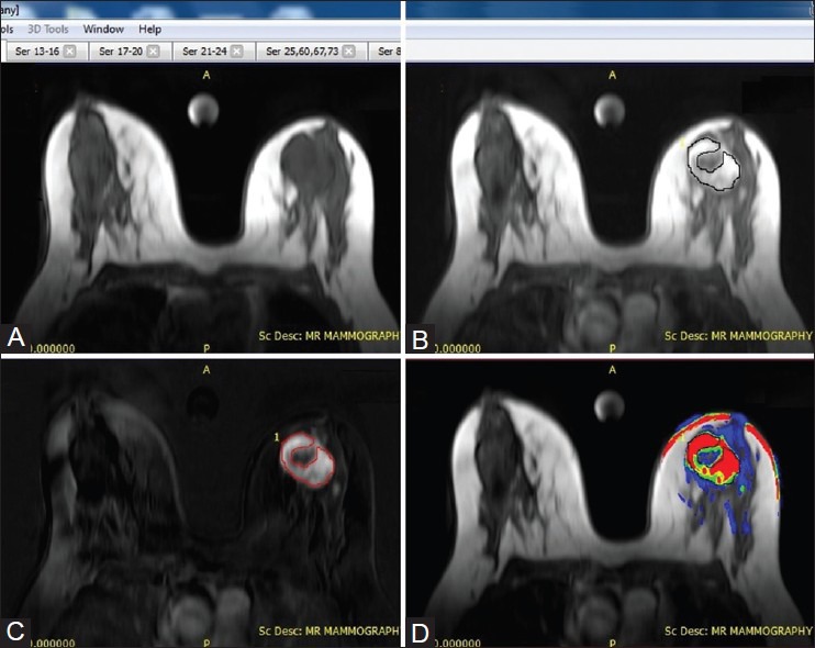 Figure 3 (A-D)