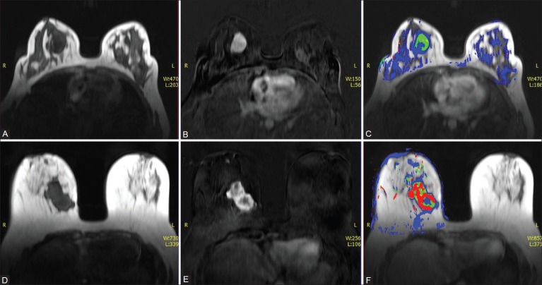 Figure 2 (A-F)