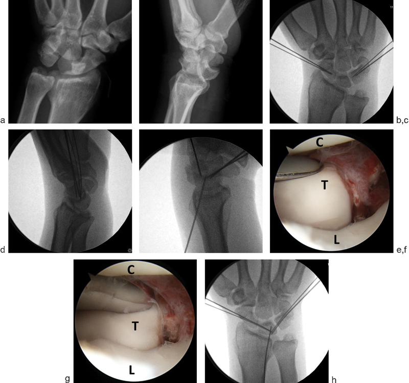 Fig. 2