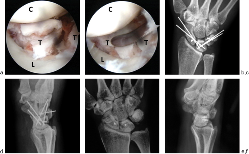 Fig. 4