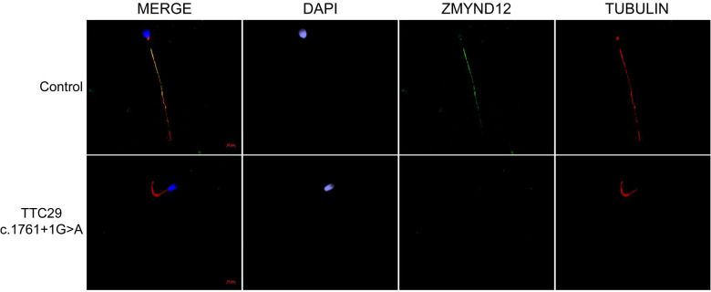 Figure 2—figure supplement 2.