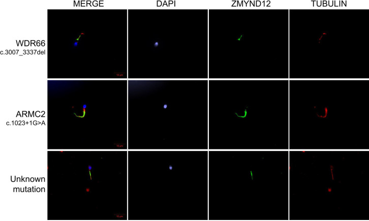 Figure 1—figure supplement 3.