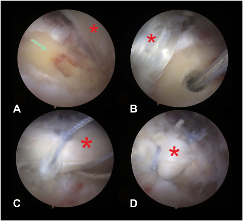 Fig. 4