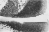 283