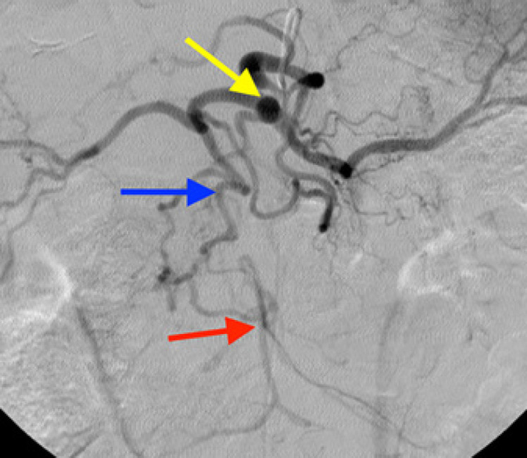 Fig. 2