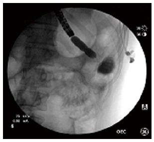 Figure 11