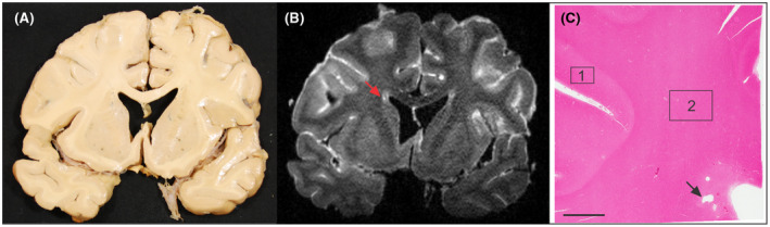 FIGURE 1