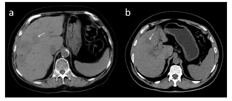 Fig. (10)