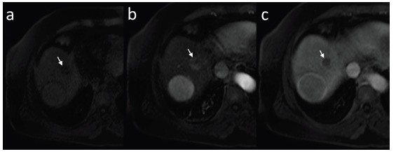 Fig. (15)