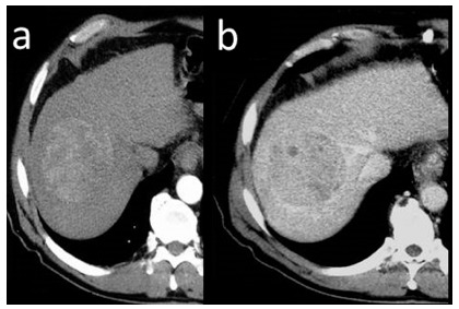 Fig. (11)