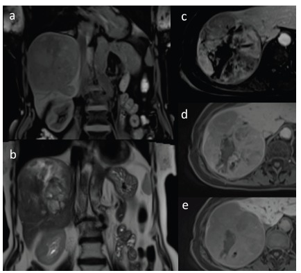 Fig. (19)