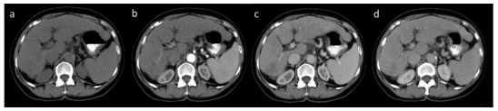 Fig. (9)