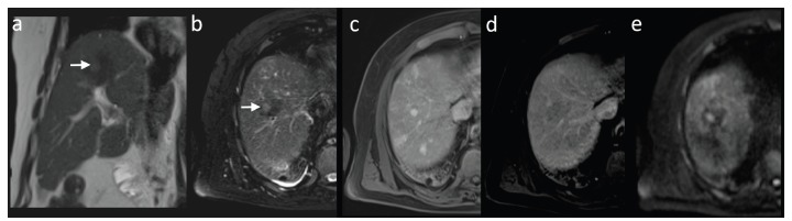 Fig. (3)