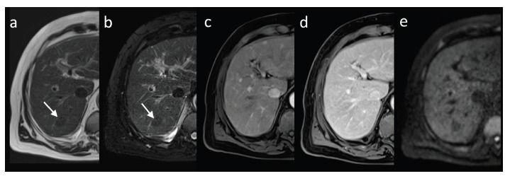 Fig. (2)