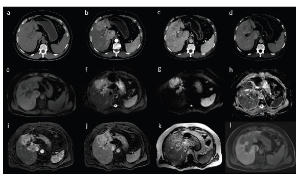 Fig. (17)