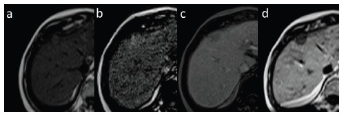 Fig. (18)