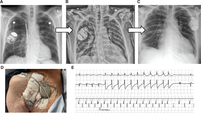 Figure 2: