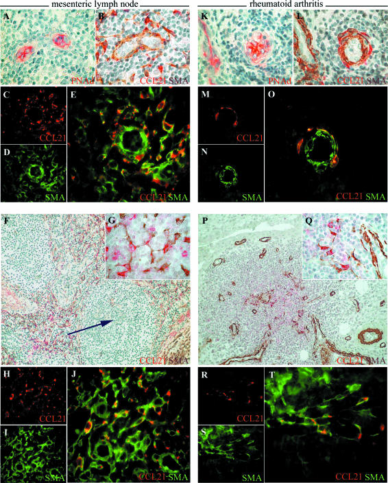 CCL21 Expression Pattern of Human Secondary Lymphoid Organ Stroma Is ...