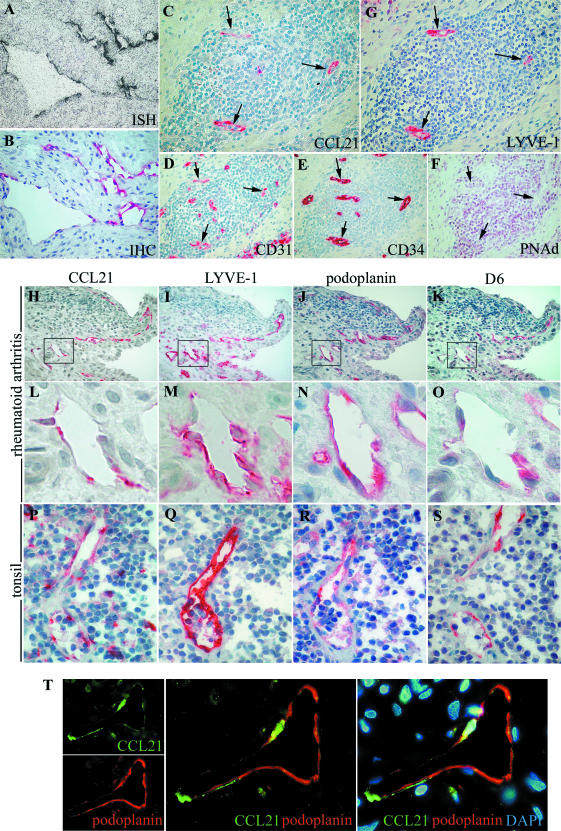 CCL21 Expression Pattern of Human Secondary Lymphoid Organ Stroma Is ...