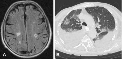 Fig. (3A).