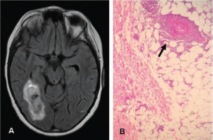 Fig. (4A).