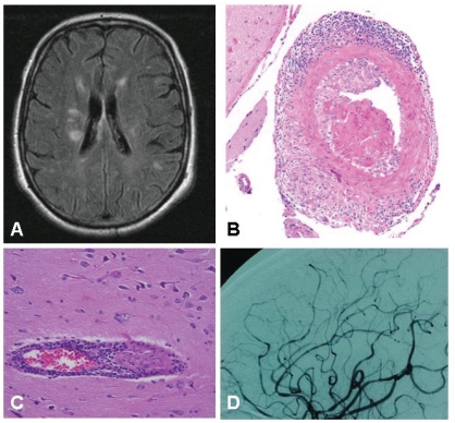 Fig. (1A).