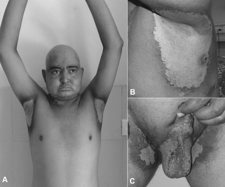 Fig. 1