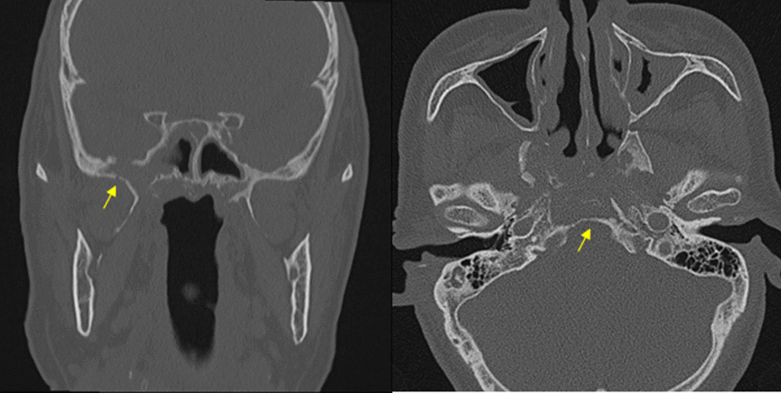 Fig. 6.