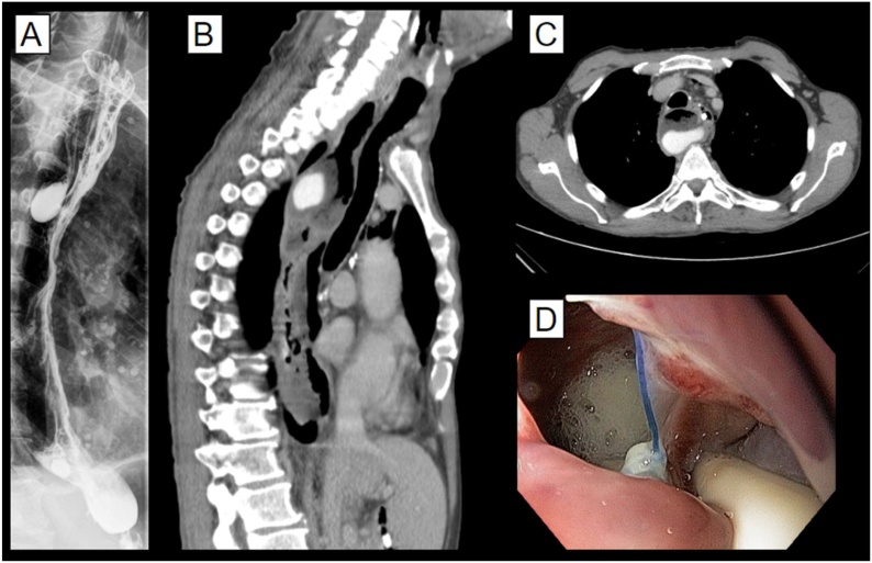 Fig. 2