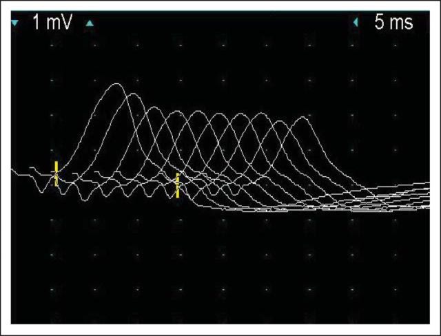 Fig 1.