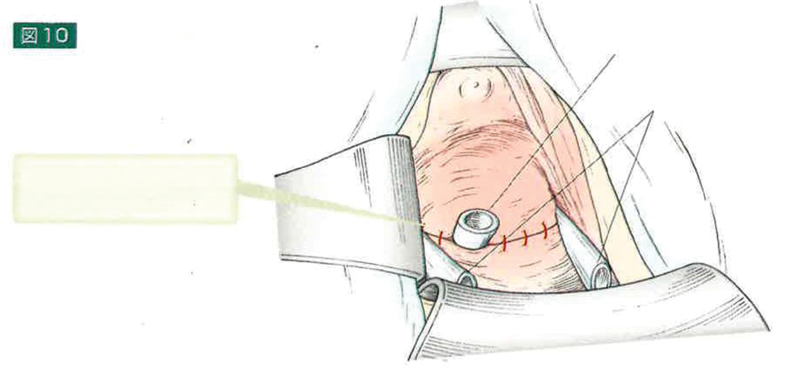 Fig. 10