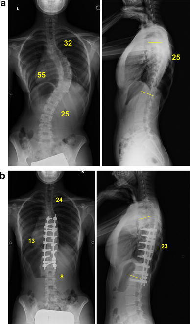 Fig. 1